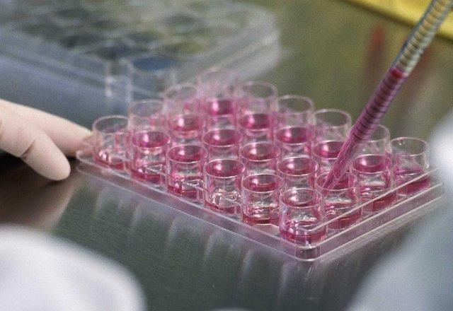 احتیاج سه میلیون ایرانی به سلول درمانی، محدودیت در تکثیر سلول های بنیادی