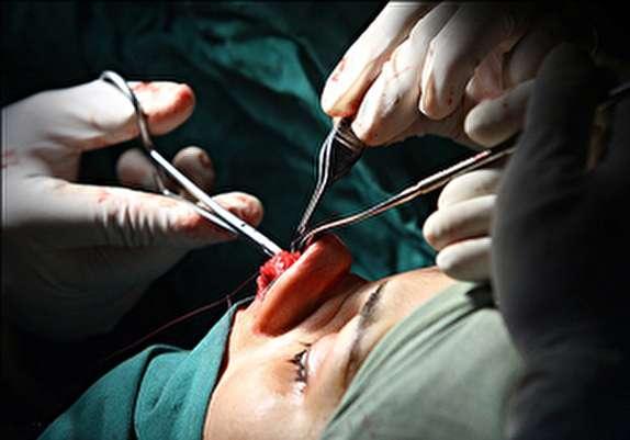 فریب تبلغات اغواکننده جراحی های زیبایی را نخورید، کدام عمل ها منجر به مرگ می شوند؟