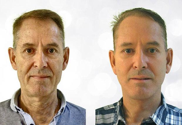 توصیه های برای پیشگیری از پیری پوست توصیه های برای پیشگیری از پیری پوست